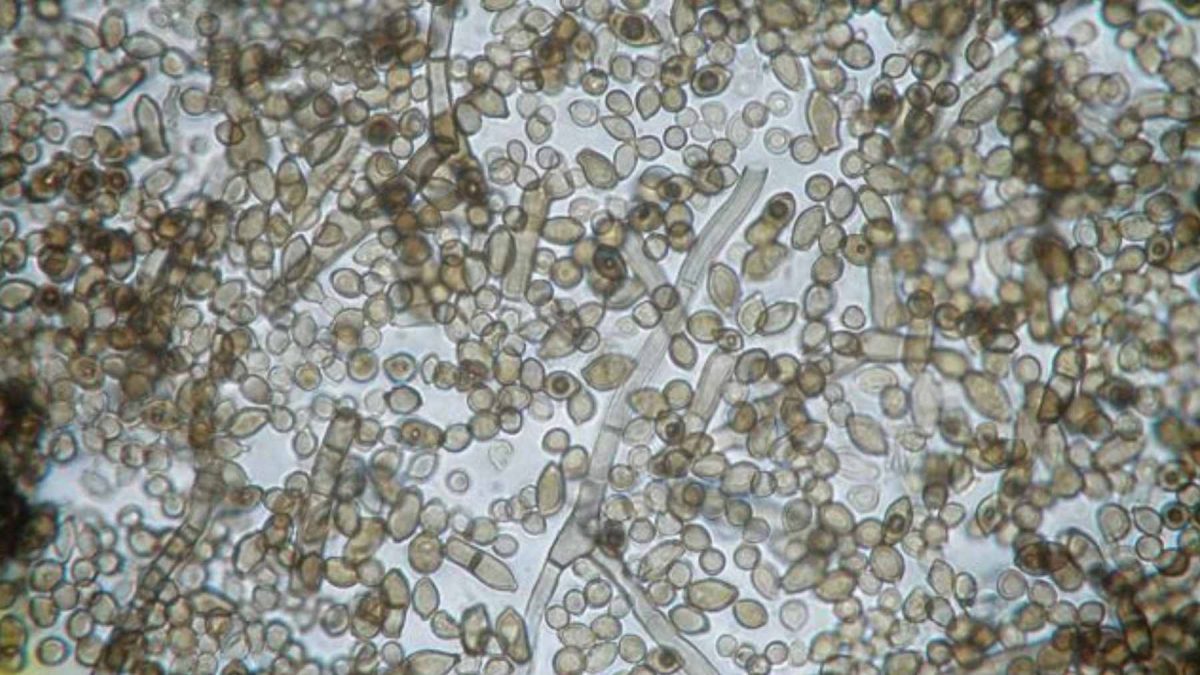 A microscopic view of Cladosporium sphaerospermum spores and hyphae, the melanin-rich fungus found in the Chernobyl reactor.