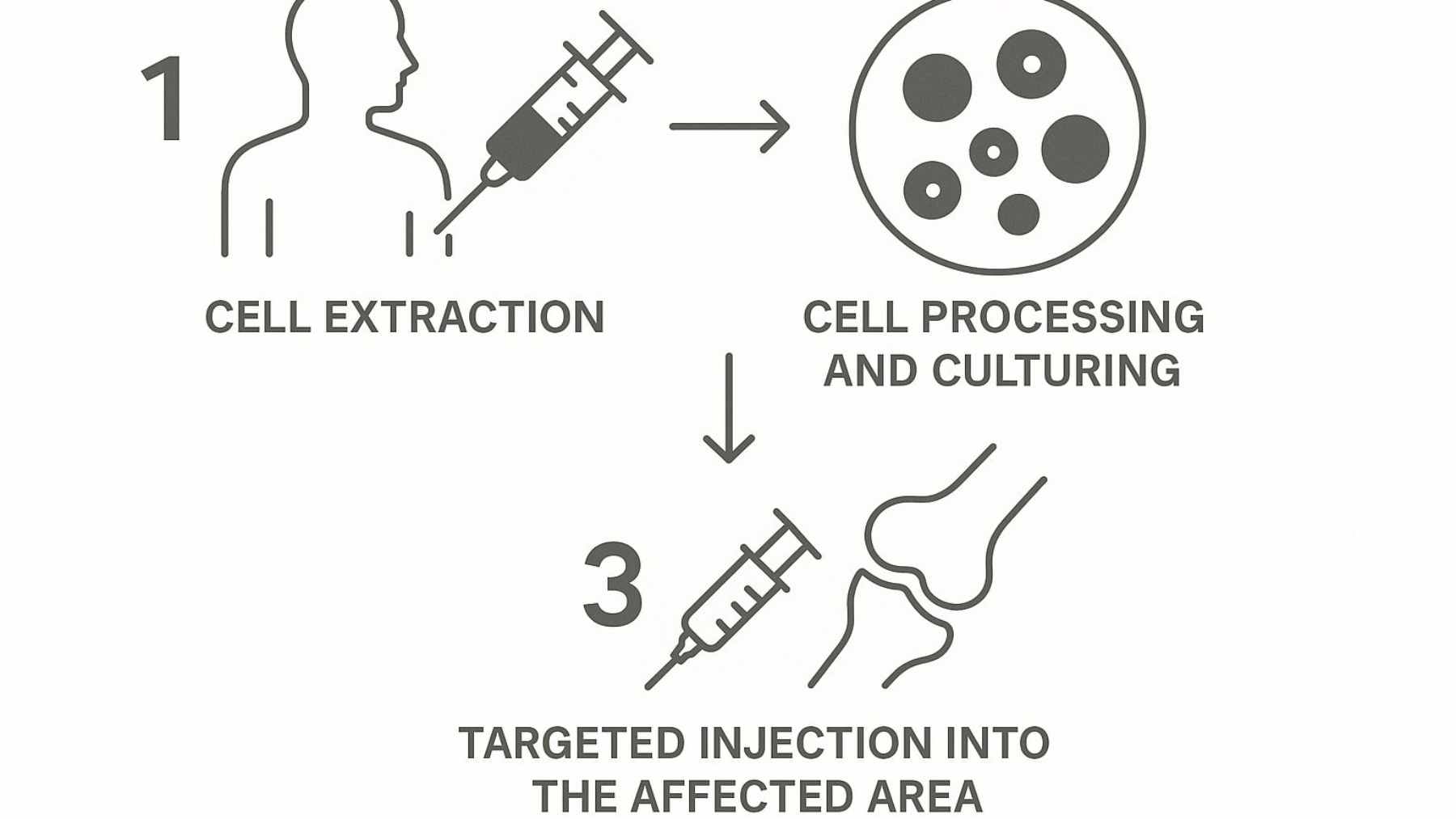 Microscopic view of human iPSC-derived nociceptors (pain-sensing neurons) used in the SN101 "pain sponge" therapy.